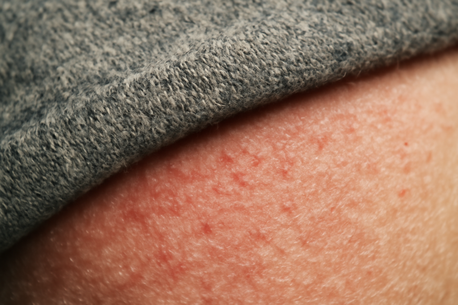 tendancemagasin-matieres-inconfort-soiree gros plan tissu irritant contre peau